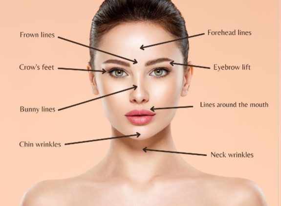 Anti-Wrinkle Injections