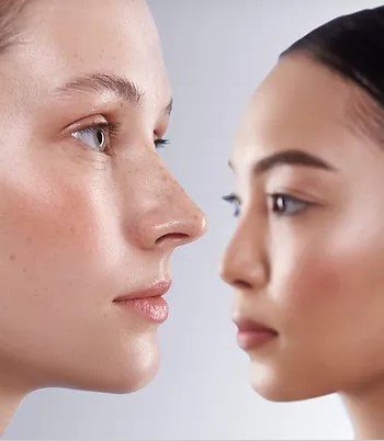 Exploring the Best Nose Dermal Fillers Available in&nbsp;London
